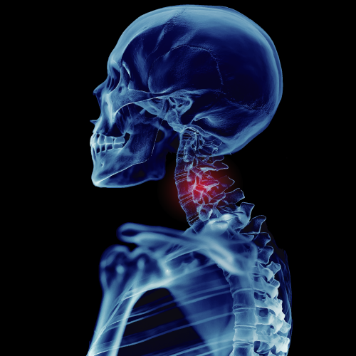 lp-17レントゲンで異常がないのに